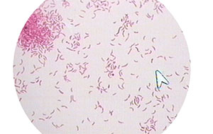 什麽是水中的熱源?